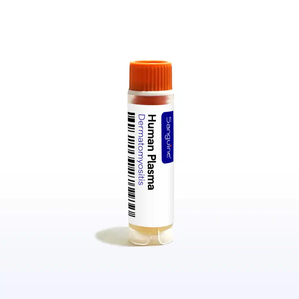 Dermatomyositis Plasma