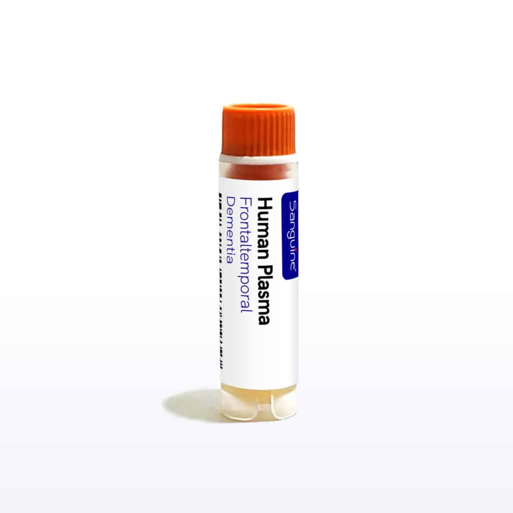 Frontotemporal Dementia Plasma