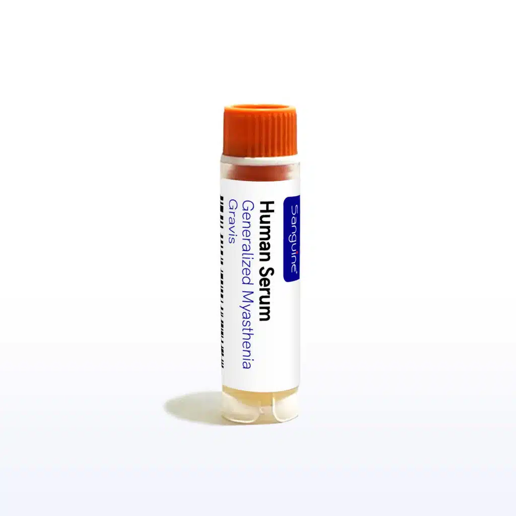 Generalized Myasthenia Gravis Serum
