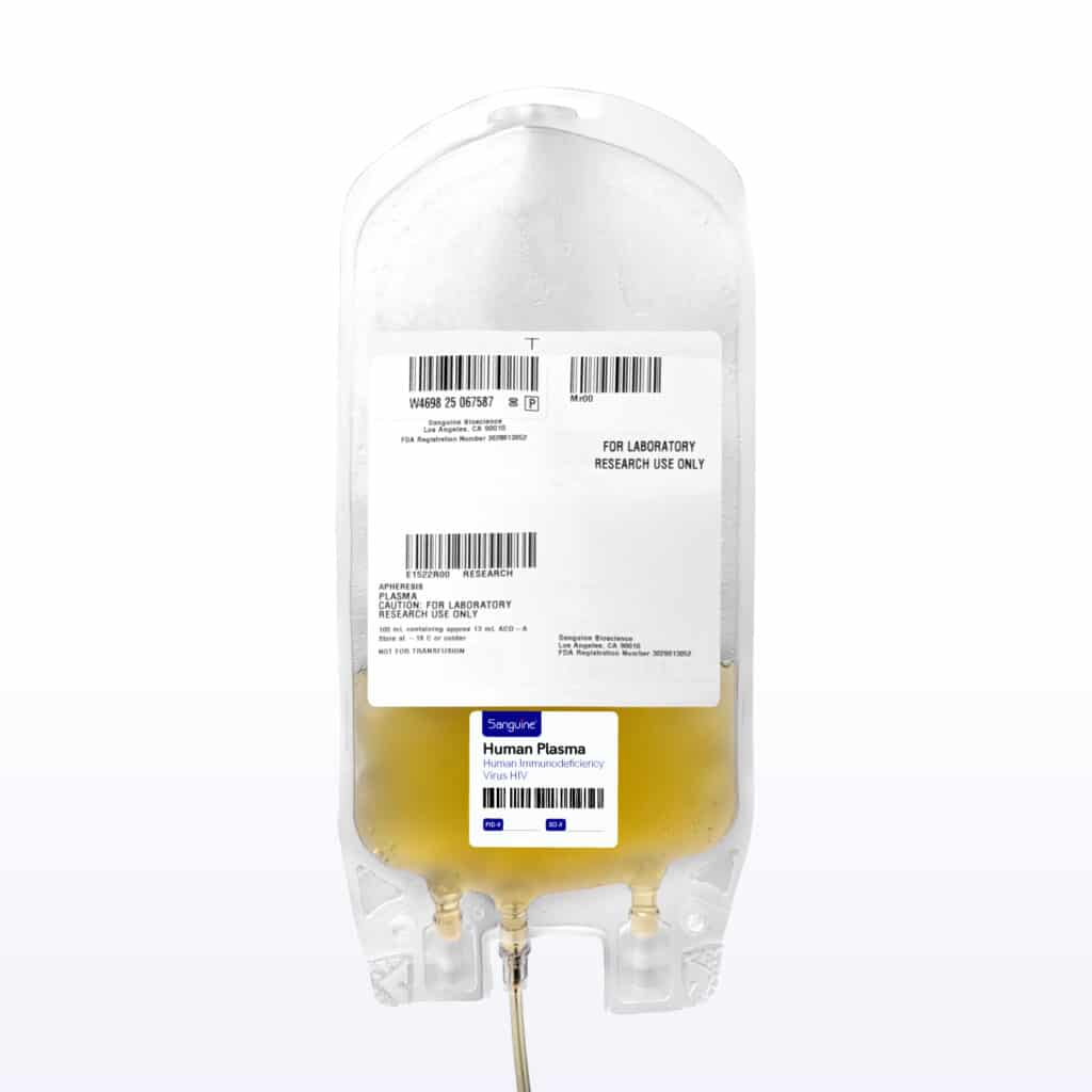 Human Immunodeficiency Virus HIV Bulk Plasma