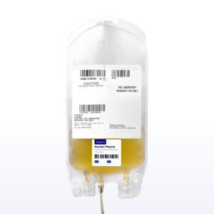 Human Immunodeficiency Virus HIV Bulk Plasma