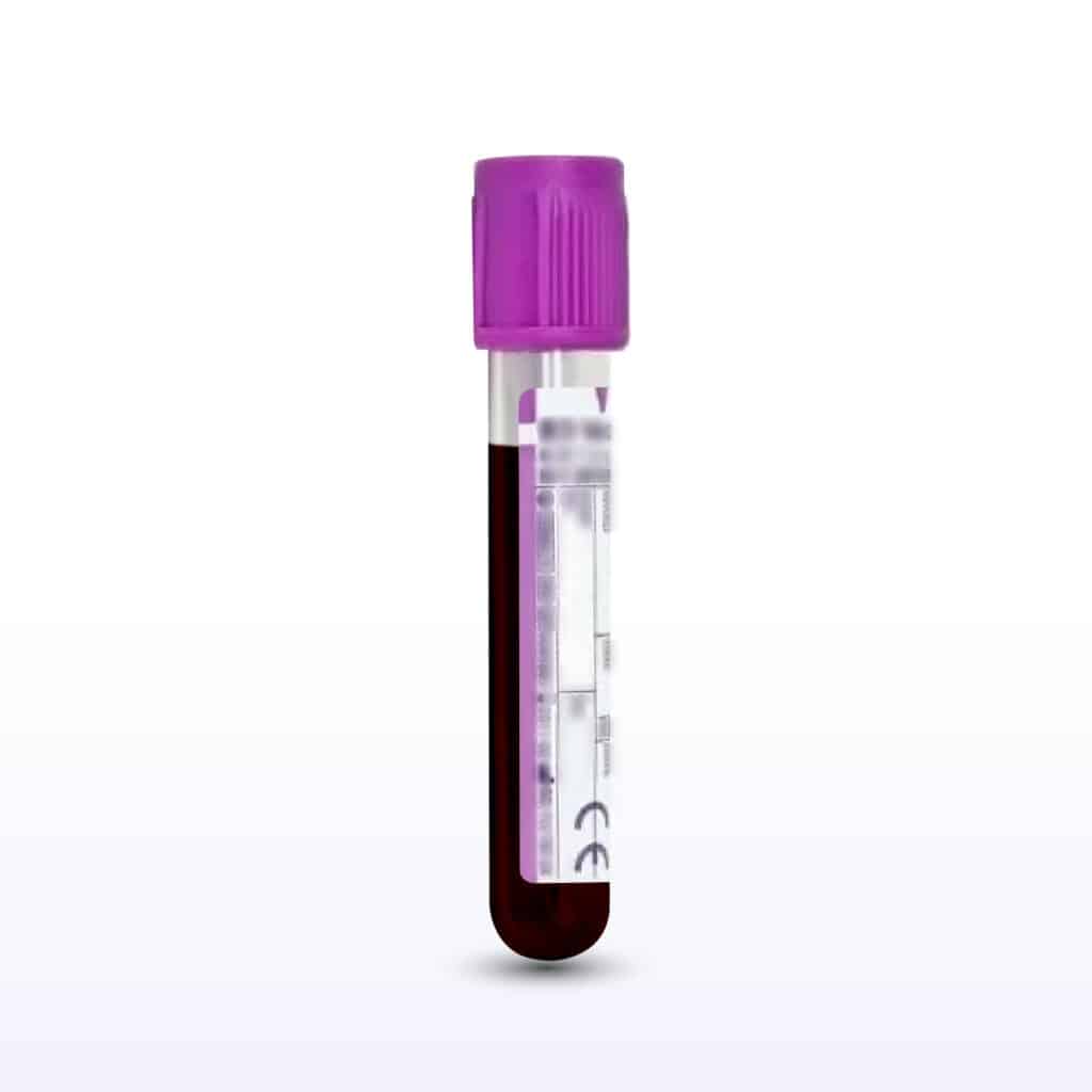 Hamartoma Whole Blood