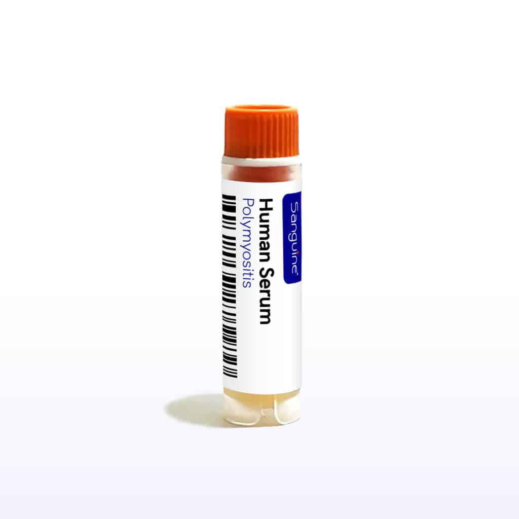 Polymyositis Serum