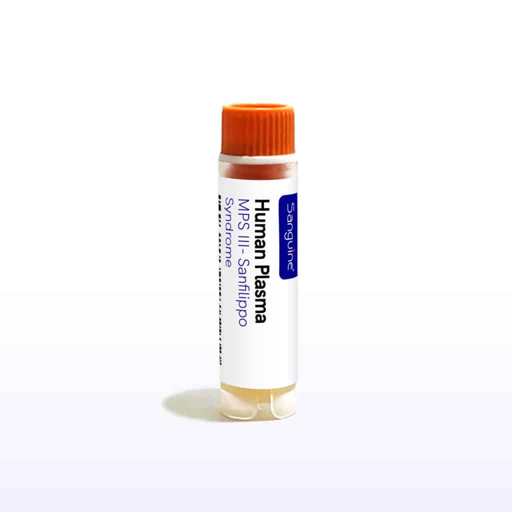 MPS III Sanfilippo Syndrome Plasma