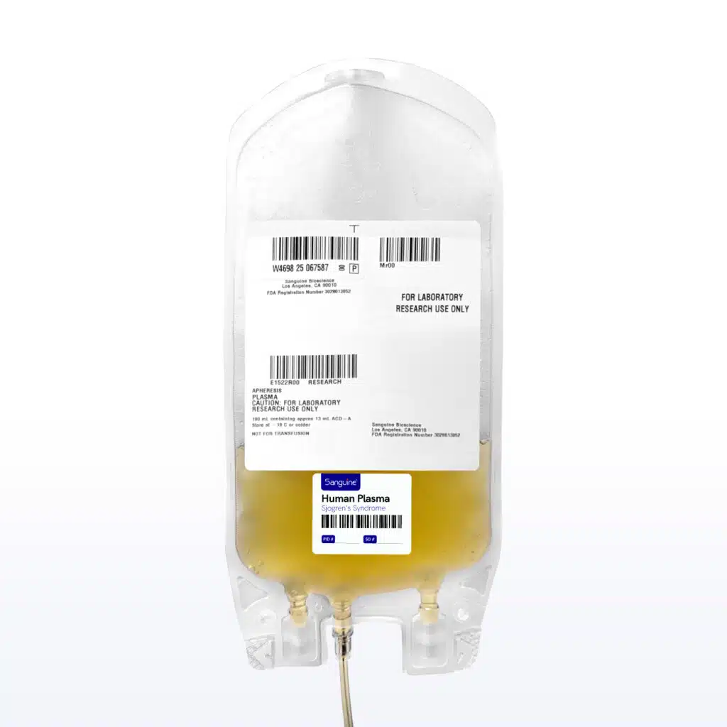 Sjögren’s Syndrome Bulk Plasma