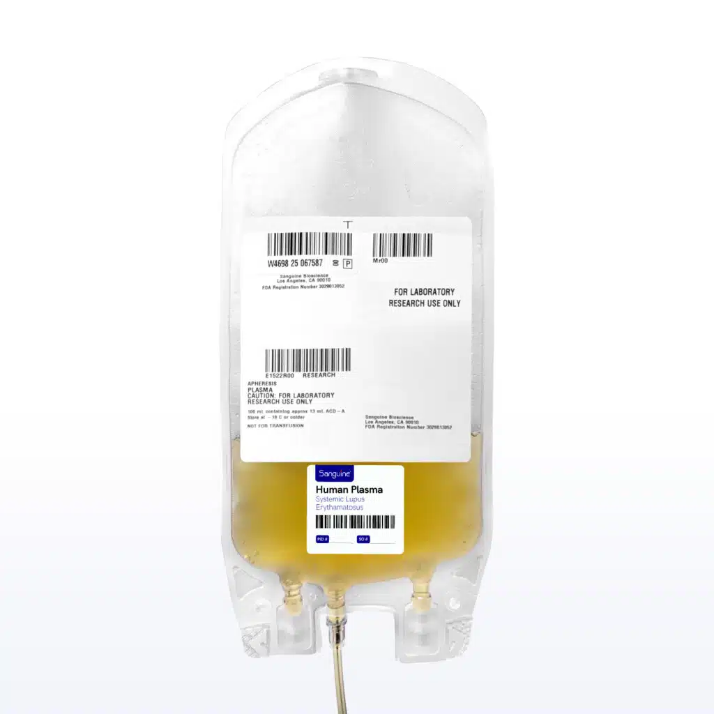 Systemic Lupus Erythematosus Bulk Plasma