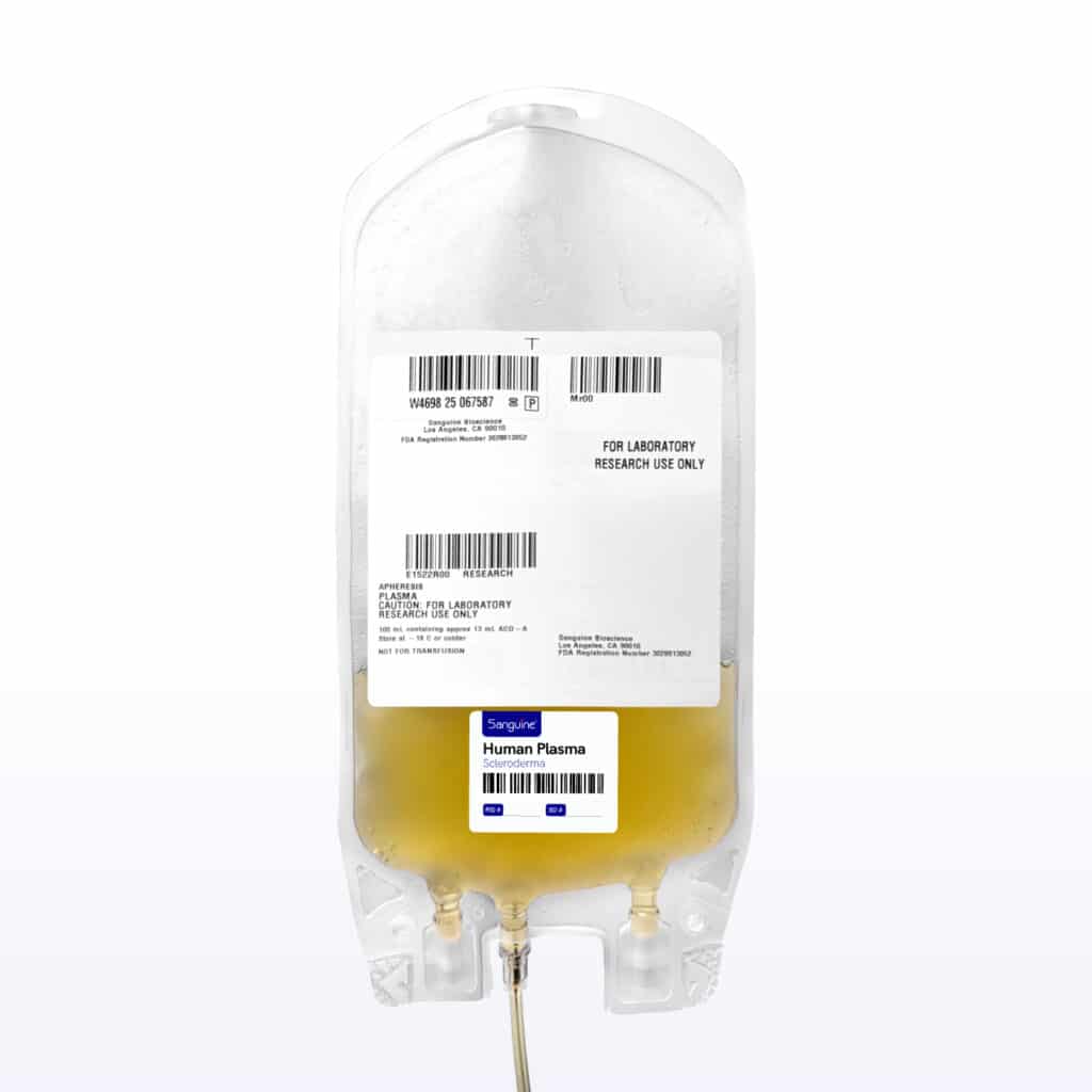 Scleroderma Bulk Plasma