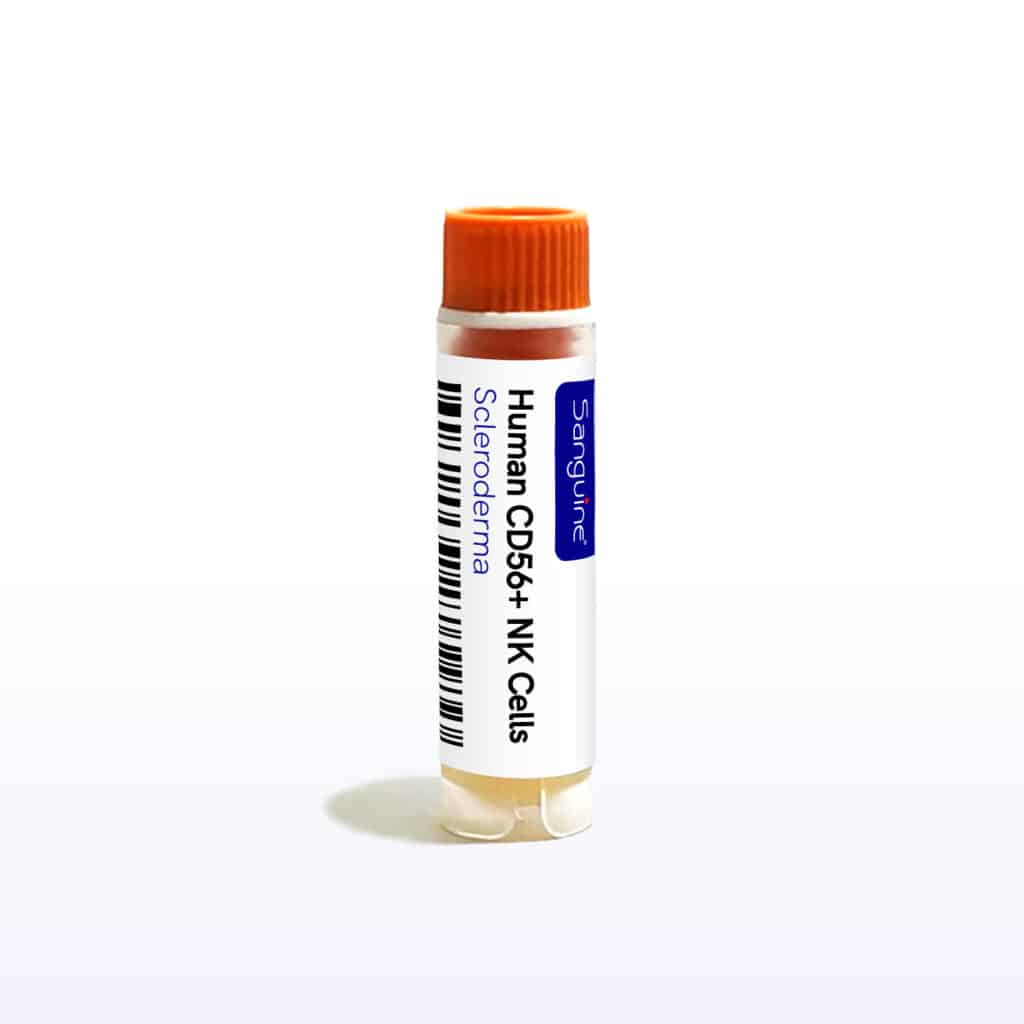 Scleroderma CD56+ NK Cells