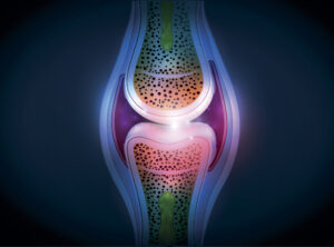 Synovial Fluid in Joint Health