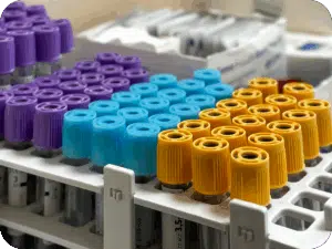 Duchenne Muscular Dystrophy Research: How Blood Biomarkers Are Replacing Muscle Biopsies 1 Blood biomarkers in Duchenne muscular dystrophy research
