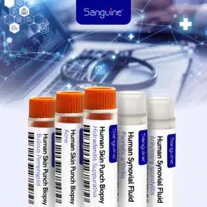 Sanguine Biosciences Skin punch biopsy and synovial fluid 1