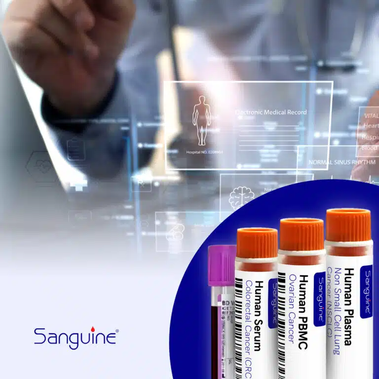 Sanguine provides oncology samples and clinical data to accelerate cancer research
