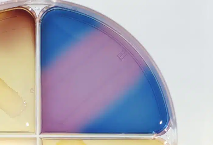 G6PD Deficiency: The Most Common Enzyme Deficiency Worldwide