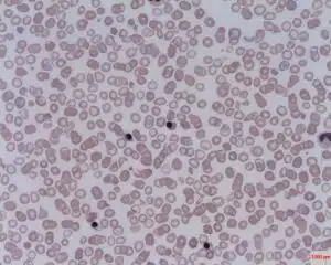 Nucleated red cells