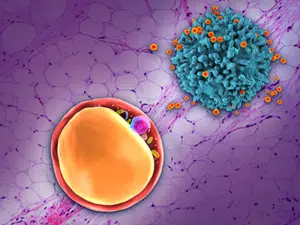 Obesity Metabolism HIV 400x300 Web Rotator