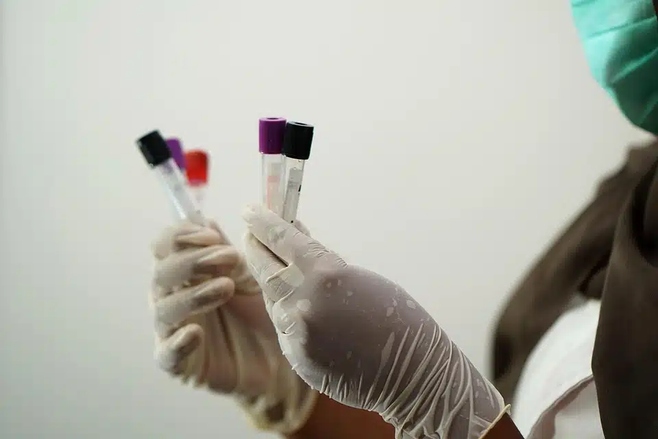 Amyloidosis Biomarkers: The Revolution in Early Detection and Diagnosis