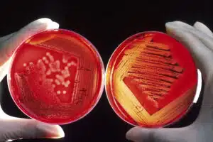 nci vol 2230 300