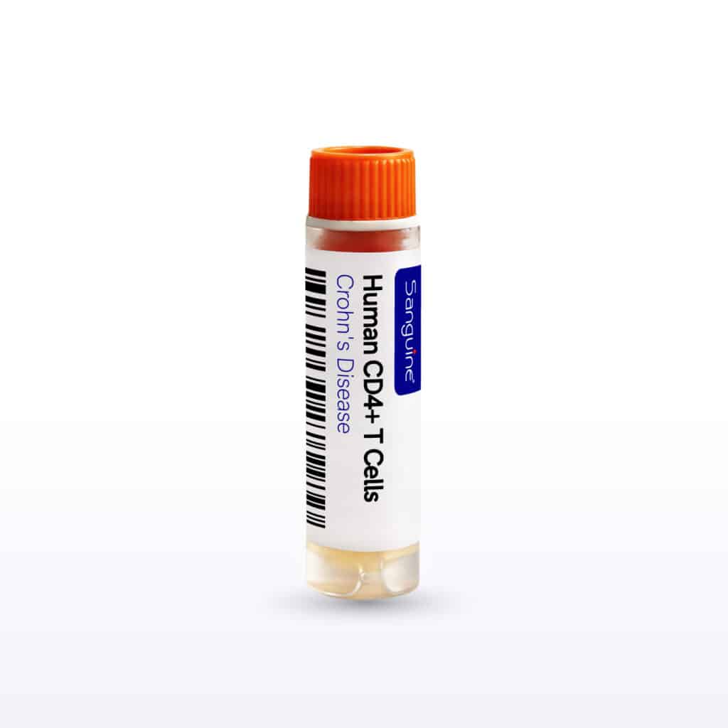 Crohn’s Disease CD4+ T Cells