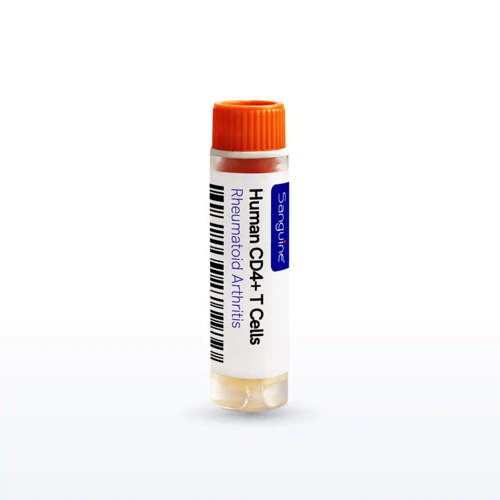 Rheumatoid arthritis CD4+ T Cells