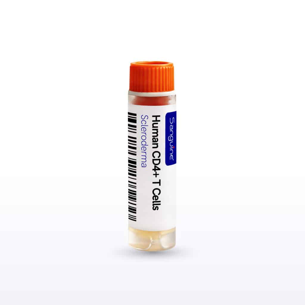 Scleroderma CD4+ T Cells
