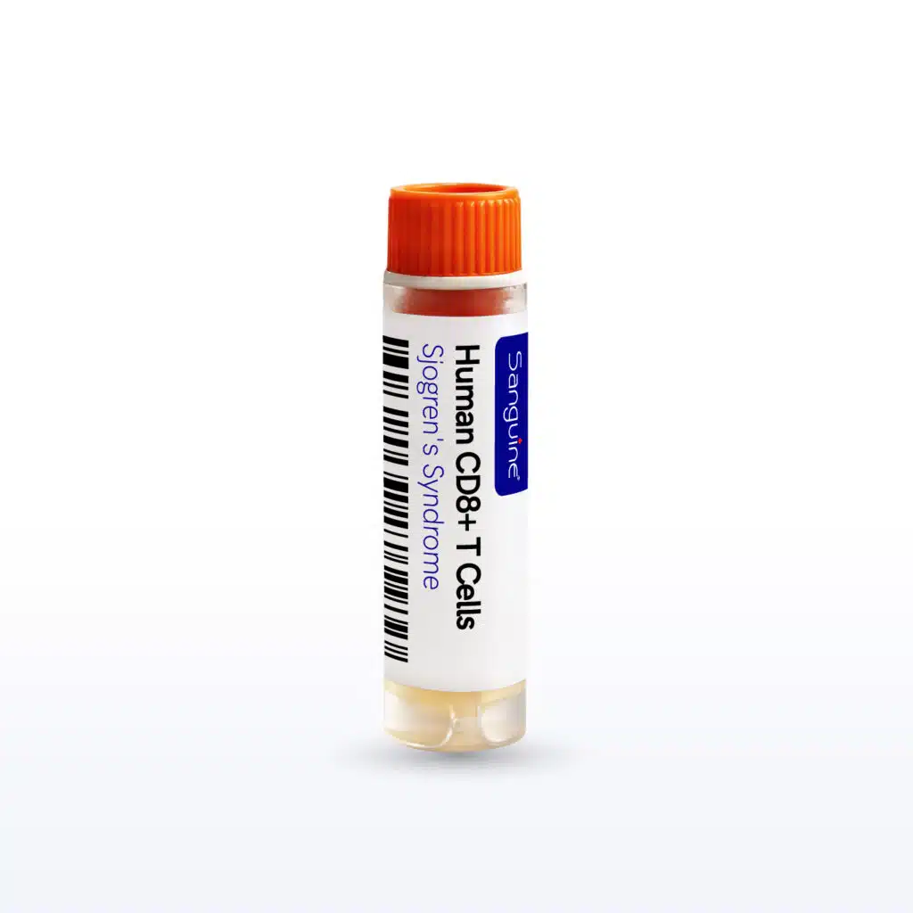Sjogren’s Syndrome CD8+ T Cells
