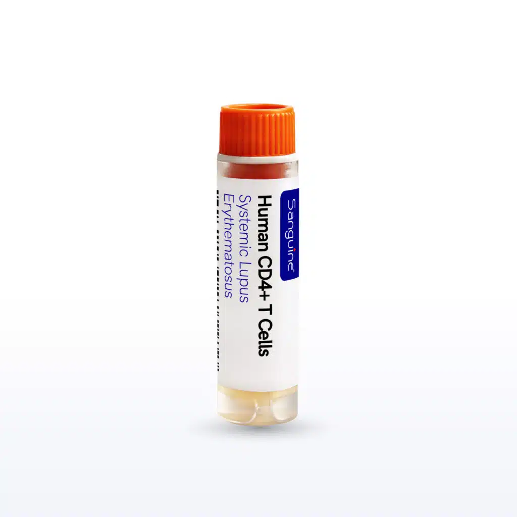 Systemic Lupus Erythematosus CD4+ T Cells