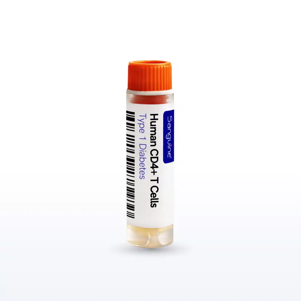 Type 1 Diabetes CD4+ T Cells