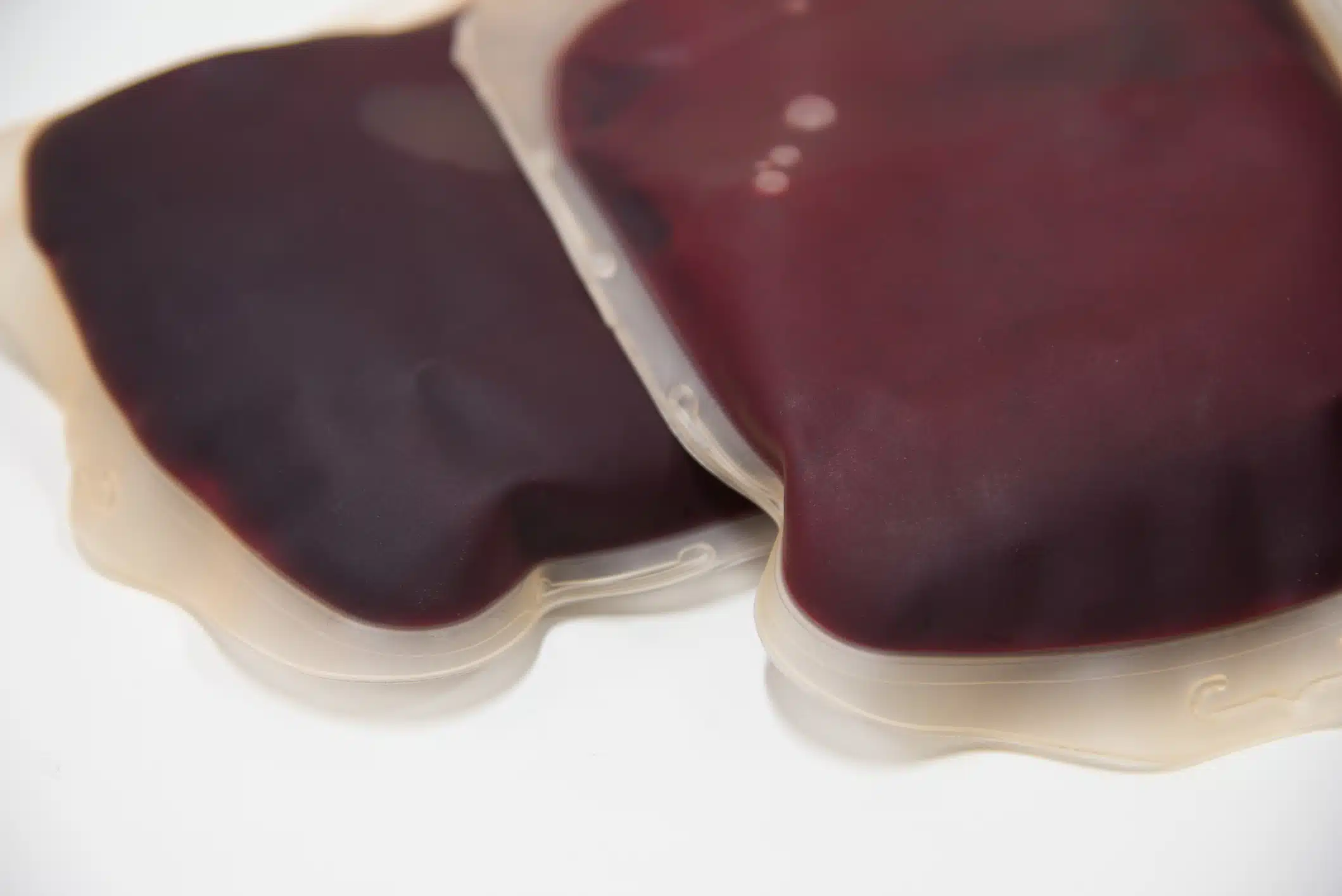 What Is a Human Leukopak? A Complete Guide for Immunology and Cell Therapy Researchers
