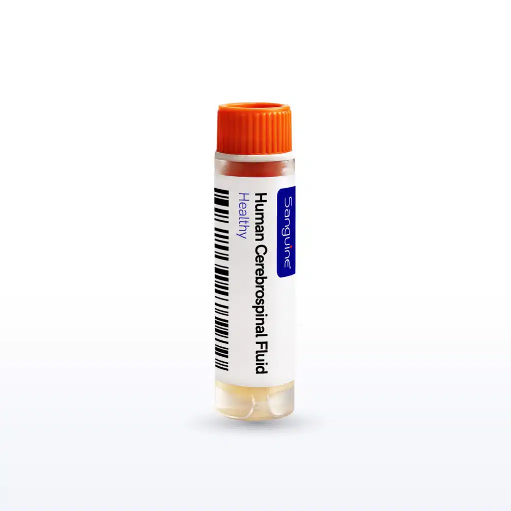 Healthy Cerebrospinal Fluid