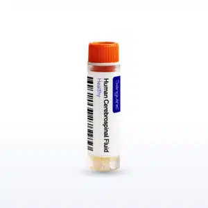 Cerebrospinal Fluid Healthy