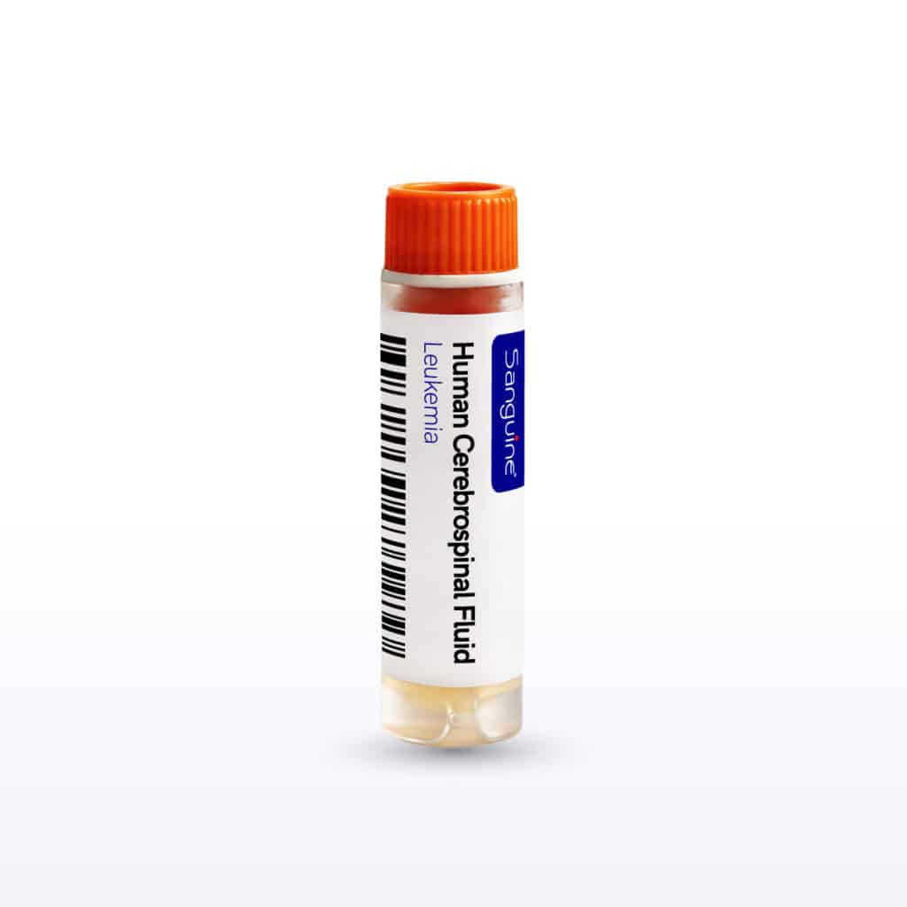 Leukemia Cerebrospinal Fluid