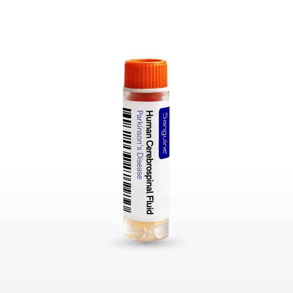 Parkinson’s Disease Cerebrospinal Fluid