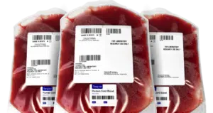Cord Blood chopped