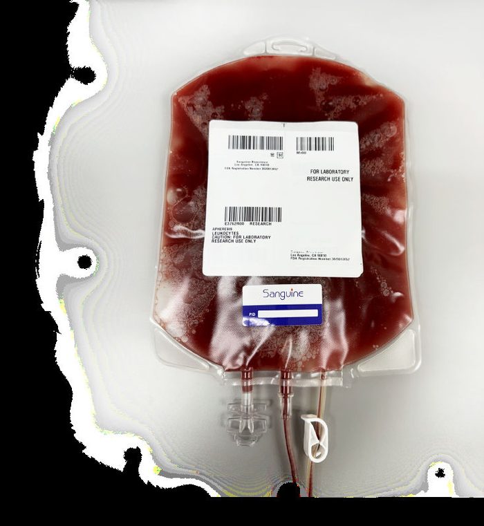 Apheresis Portfolio — Leukopaks & Leukopak-derived PBMCs 1 Sanguine leukopak product