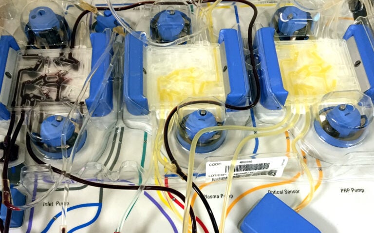 Apheresis cell separator machine used to collect leukopaks