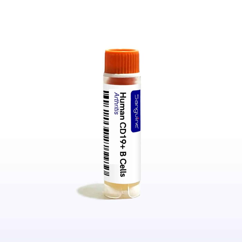 Arthritis CD19+ B Cells