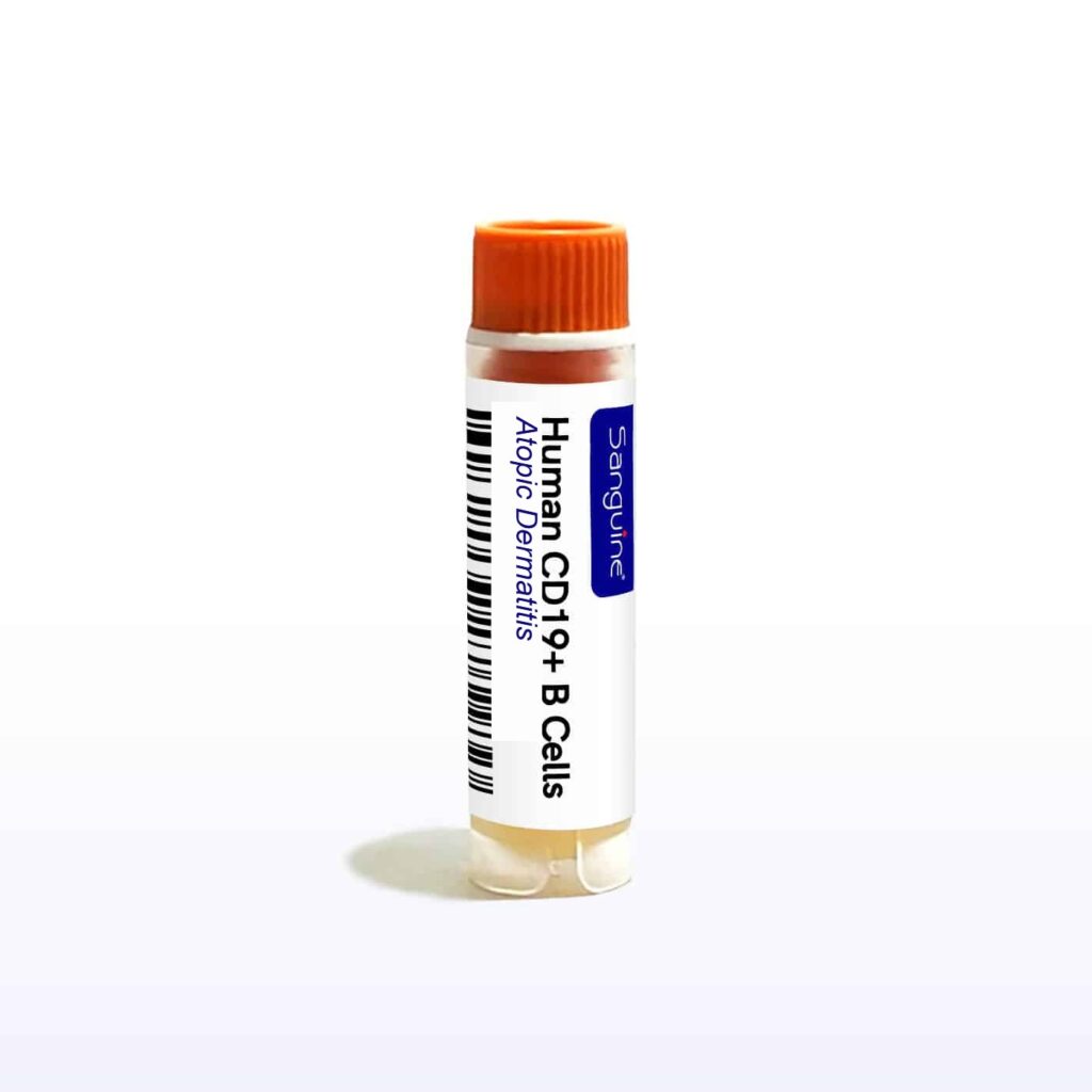 Atopic Dermatitis CD19+ B Cells