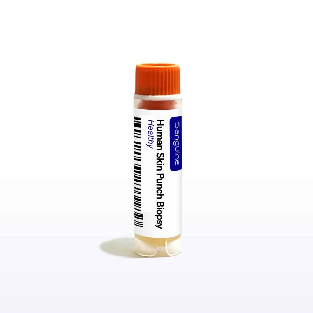 Healthy Skin Punch Biopsy