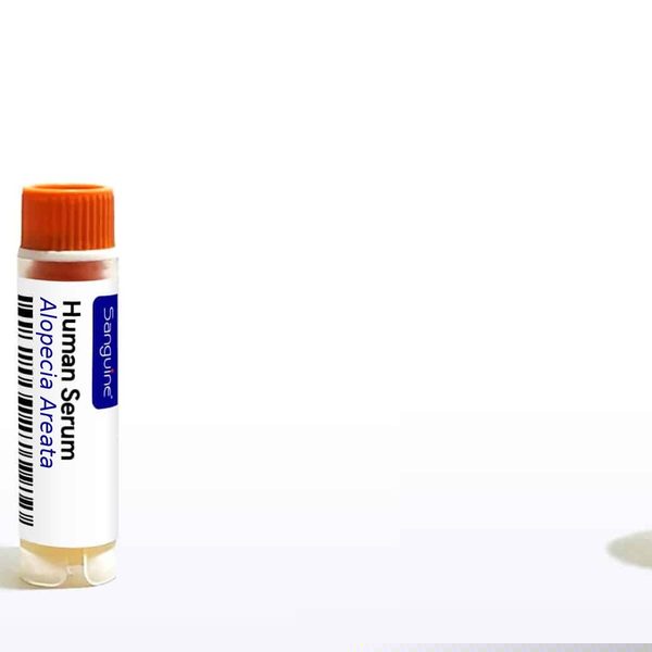 Alopecia Areata Serum