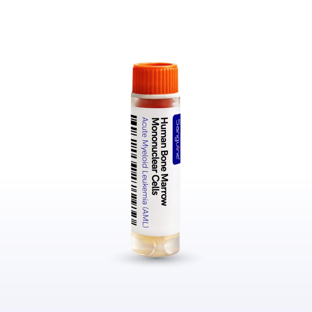 Acute Myeloid Leukemia (AML) Bone Marrow Mononuclear Cells