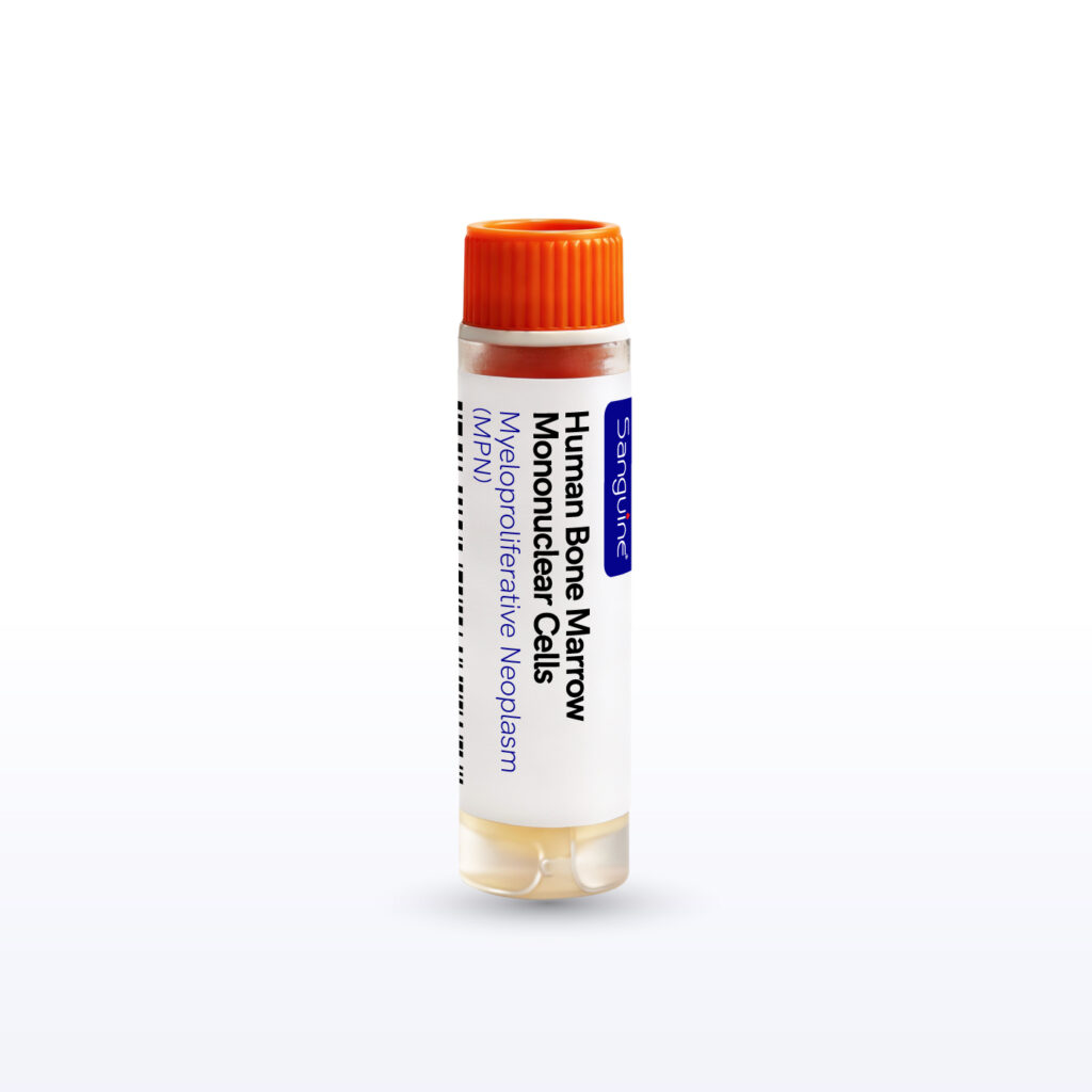 Myeloproliferative Neoplasm (MPN) Bone Marrow Mononuclear Cells