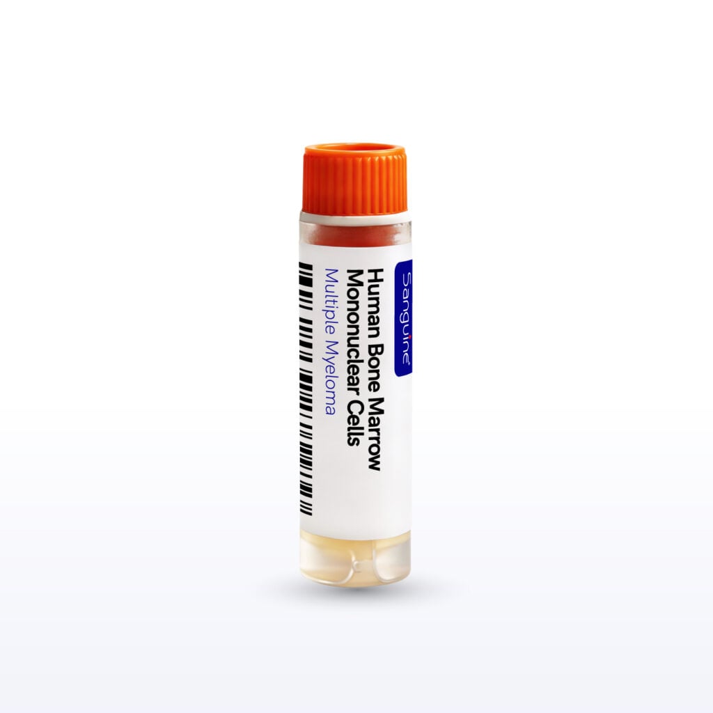 Multiple Myeloma Bone Marrow Mononuclear Cells