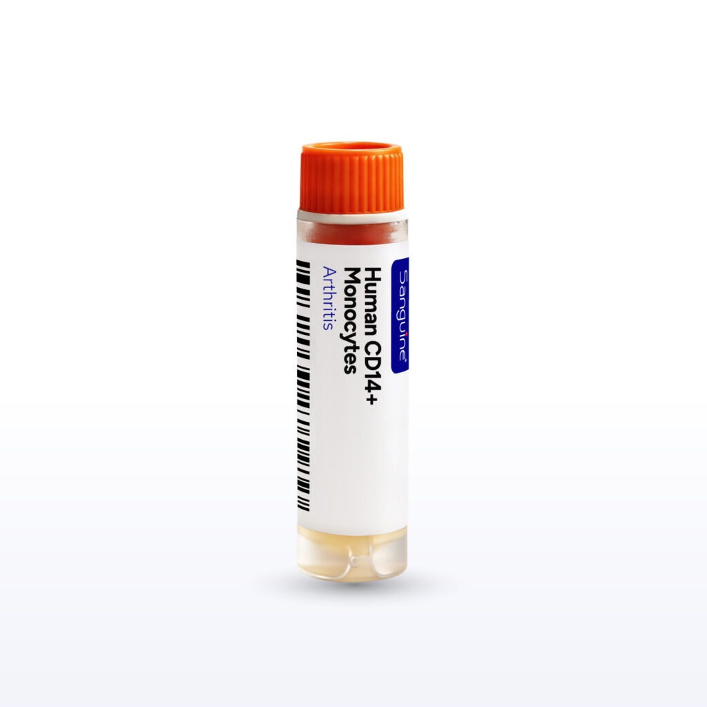 Arthritis CD14+ Monocytes