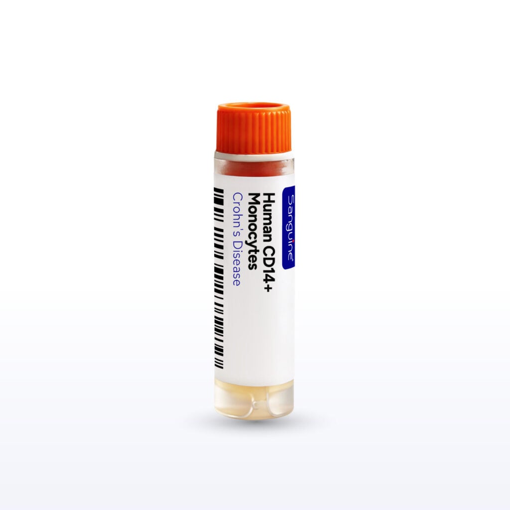 Crohn’s Disease CD14+ Monocytes